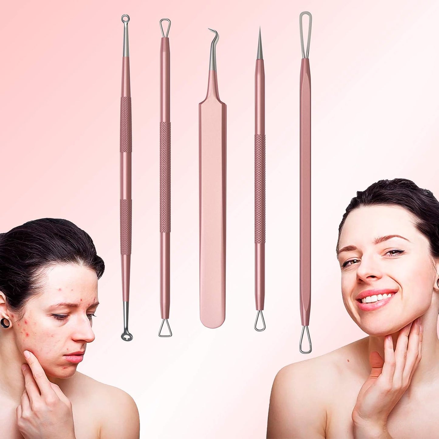 Blackhead Remover Pimple Popper Tool Kit - Professional Extractor for Nose and Face, Stainless Comedone, Blemish Whitehead Popping with Portable Metal Case.